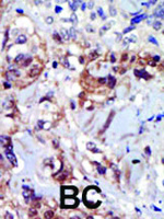 Anti-PIP4K2A Rabbit Polyclonal Antibody