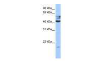 Anti-QTRT1 Rabbit Polyclonal Antibody
