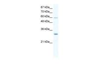 Anti-DDX31 Rabbit Polyclonal Antibody