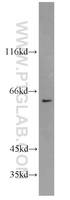 Anti-SLC25A12 Rabbit Polyclonal Antibody