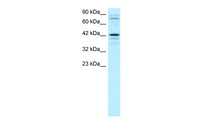Anti-SOX18 Rabbit Polyclonal Antibody