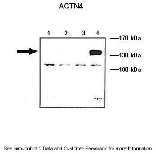 ACTIN ALPHA 4 antibody
