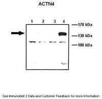Anti-ACTN4 Rabbit Polyclonal Antibody