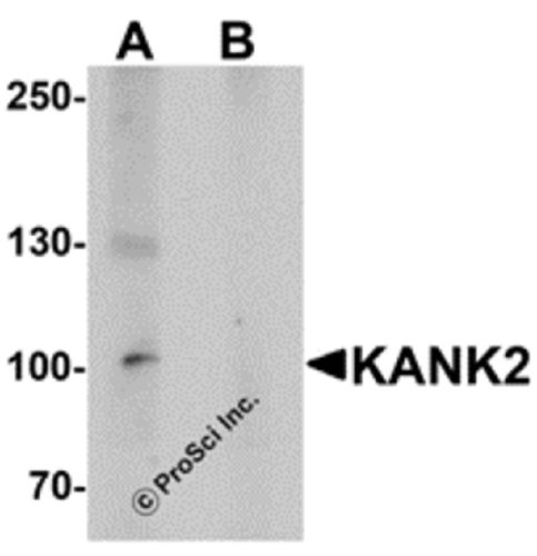 KANK2 antibody
