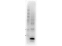 Anti-CALCA Mouse Monoclonal Antibody [clone: 9D9.E11.C3.E8.F4.D4]