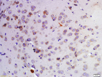 Anti-KDM1A Rabbit Polyclonal Antibody