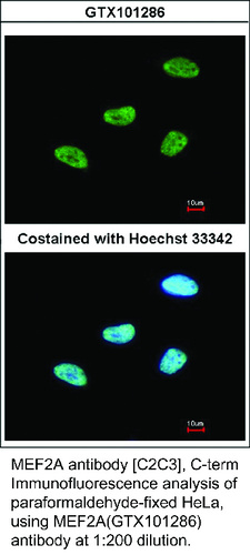 Rabbit Polyclonal antibody to MEF2A (myocyte enhancer factor 2A)