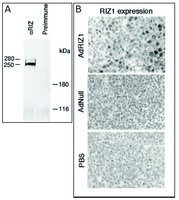 Anti-PRDM2 Rabbit Polyclonal Antibody