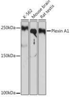 Anti-Plexin A1 Rabbit Monoclonal Antibody [clone: ARC2077]