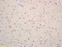 Anti-CDKN1C Rabbit Polyclonal Antibody