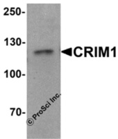 Anti-CRIM1 Rabbit Polyclonal Antibody