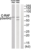 Anti-RAF1 Rabbit Polyclonal Antibody