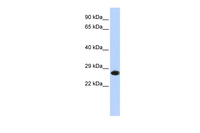 Anti-PSMA2 Rabbit Polyclonal Antibody