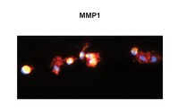 Anti-MMP1 Rabbit Polyclonal Antibody