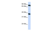 Anti-GP6 Rabbit Polyclonal Antibody