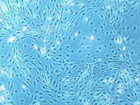 Human dermal microvascular endothelial cells (HDMEC), PromoCell