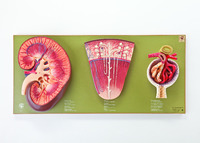 Somso® Kidney Structures Model