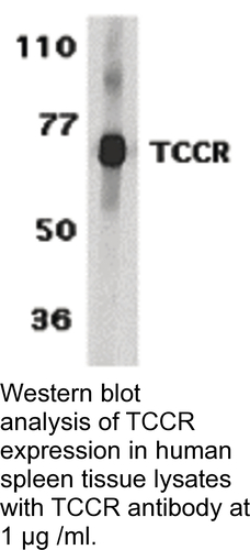 Antibody TCCR 0.1MG
