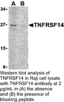 Anti-TNFRSF14 Rabbit Polyclonal Antibody