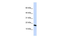 Anti-H2AFX Rabbit Polyclonal Antibody