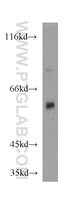 Anti-CYP4A11 Rabbit Polyclonal Antibody