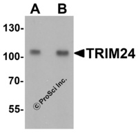 Anti-TRIM24 Rabbit Polyclonal Antibody