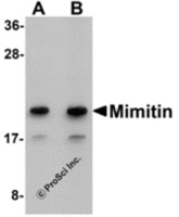 Anti-NDUFAF2 Rabbit Polyclonal Antibody