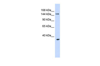 Anti-UBE3B Rabbit Polyclonal Antibody