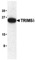 Anti-TRIM5 Rabbit Polyclonal Antibody