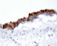 Anti-AP1G1 Rabbit Polyclonal Antibody