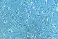 Human Cardiac Fibroblasts (HCF), PromoCell