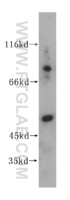 Anti-GALNS Rabbit Polyclonal Antibody