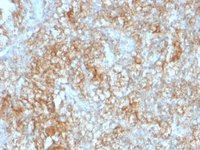 Anti-CD147 Mouse Monoclonal Antibody [clone: 8D6]