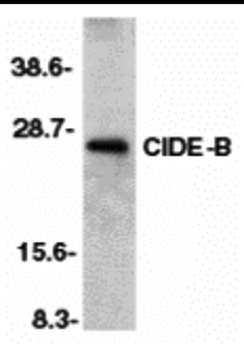 CIDE-B antibody