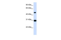 Anti-PSMC3 Rabbit Polyclonal Antibody