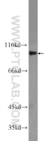 Anti-FER Rabbit Polyclonal Antibody