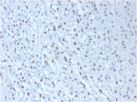 Anti-Wilms Tumor Protein Mouse Monoclonal Antibody [clone: WT1/857 + 6F-H2]
