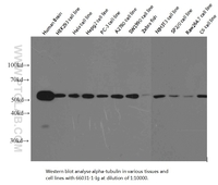 Anti-TUBA1 Mouse Monoclonal Antibody [clone: 1E4C11]