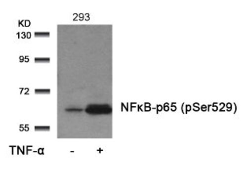 NFkB p65 (phospho Ser529) Antibody