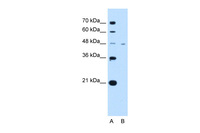 Anti-SLC16A1 Rabbit Polyclonal Antibody