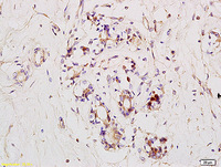 Anti-RNF31 Rabbit Polyclonal Antibody