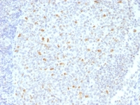 Anti-Bcl-6 Mouse Monoclonal Antibody [clone: BCL6/1526]