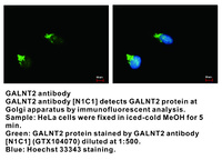 Anti-GALNT2 Rabbit Polyclonal Antibody
