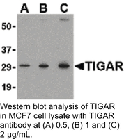 Anti-TIGAR Rabbit Polyclonal Antibody