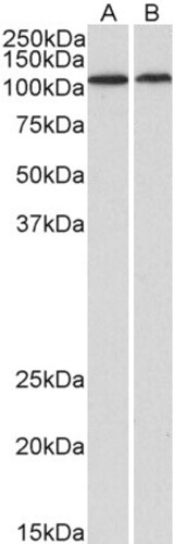 ANTIBODY ANTI-BMP1 100UG