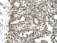 Anti-GTF2H2 Rabbit Polyclonal Antibody