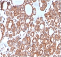 Anti-Calcitonin Mouse Monoclonal Antibody [clone: CALCA/3310]
