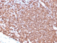 Anti-CD20 Mouse Monoclonal Antibody [Clone: MS4A1/4655]