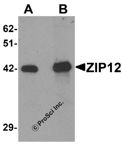 ZIP12 antibody