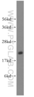 Anti-RAB35 Rabbit Polyclonal Antibody